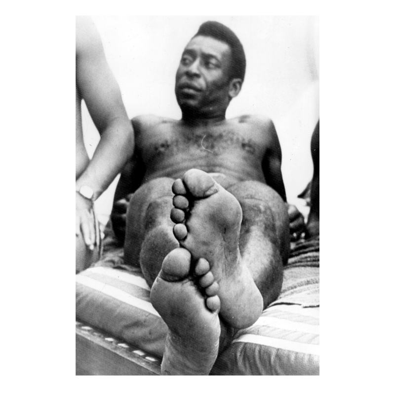 I piedi di Pelé, 1975
